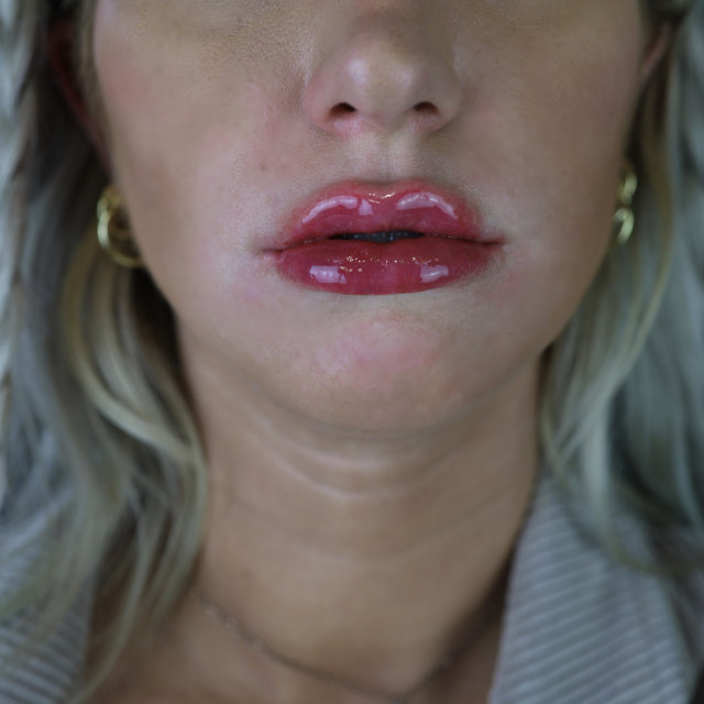 Close-up of a woman's lips, slightly parted, wearing glossy red lipstick, with a focus on her lower face and neck.
