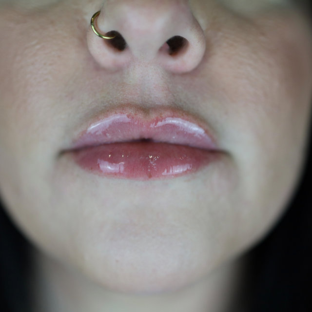 Close-up view of a person's lower face showing lips and a nose with a gold nose ring.