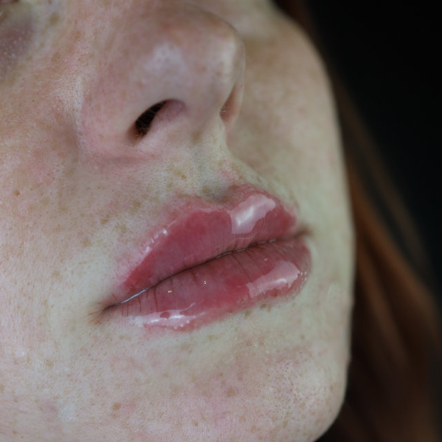 Close-up of a woman's lower face, focusing on her glossy lips and freckled skin.