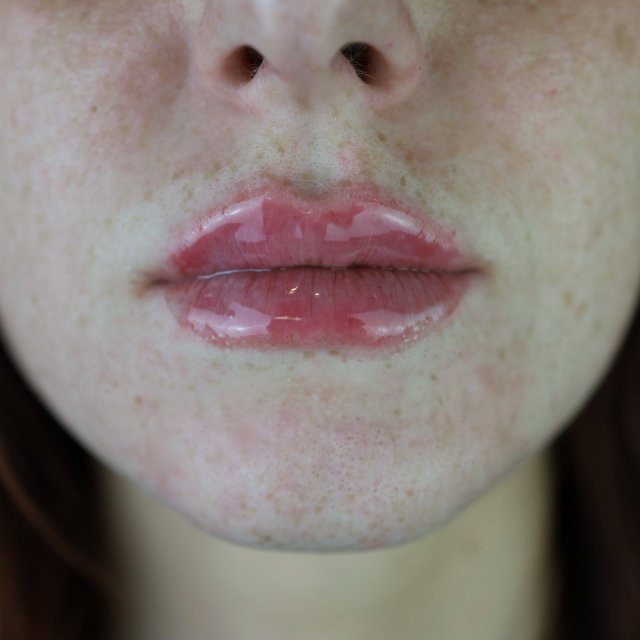 Close-up of a woman's lower face showing her lips and the base of her nose, highlighting her skin texture and natural lip color.