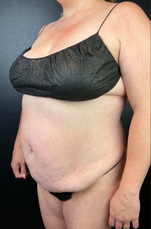 A close-up of a pregnant person wearing a black bandeau top against a dark background, focusing on the belly and upper body.