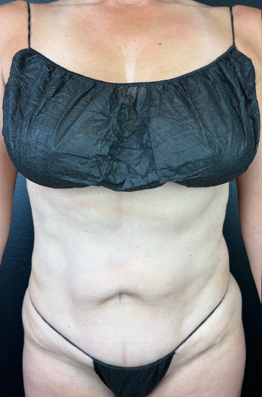 A close-up photo of a person wearing a black strapless top and black underwear, focusing on the torso area.